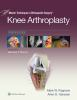 Knee_arthroplasty